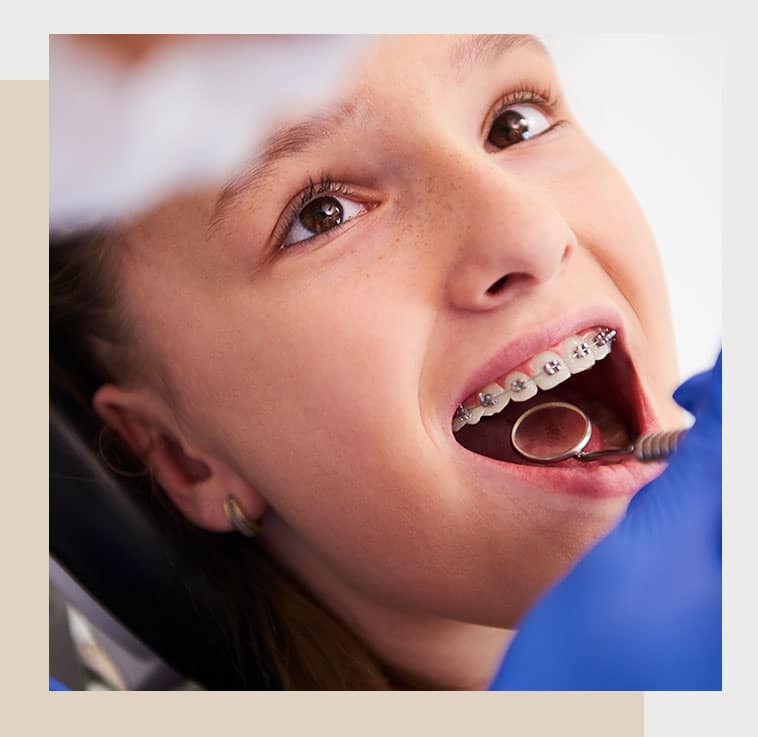 Ortodontia em Adolescentes