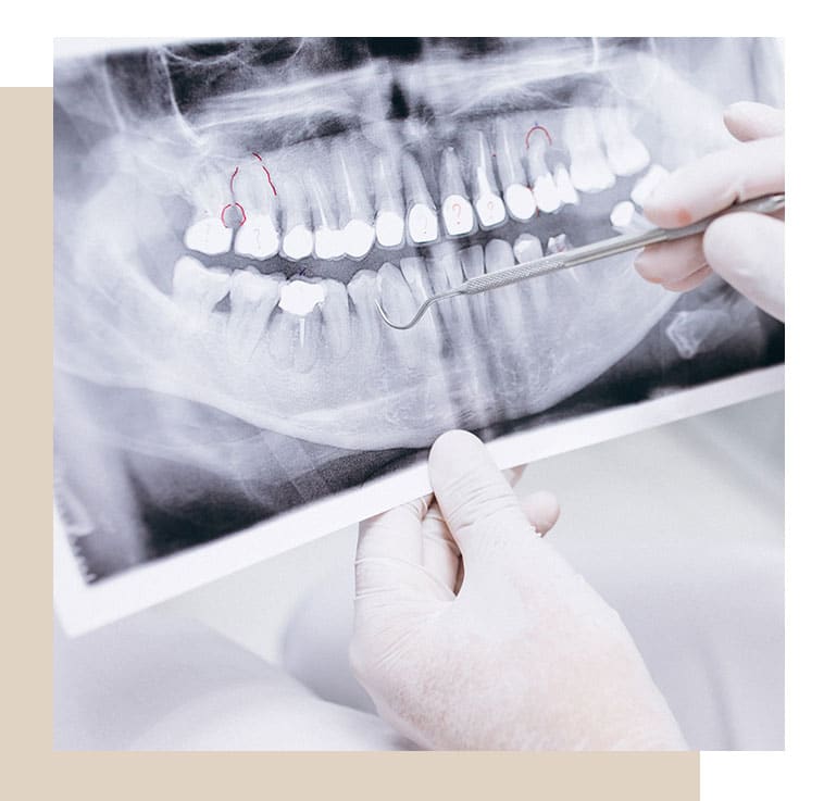 Ortodontia em Adultos - Dentes Tortos