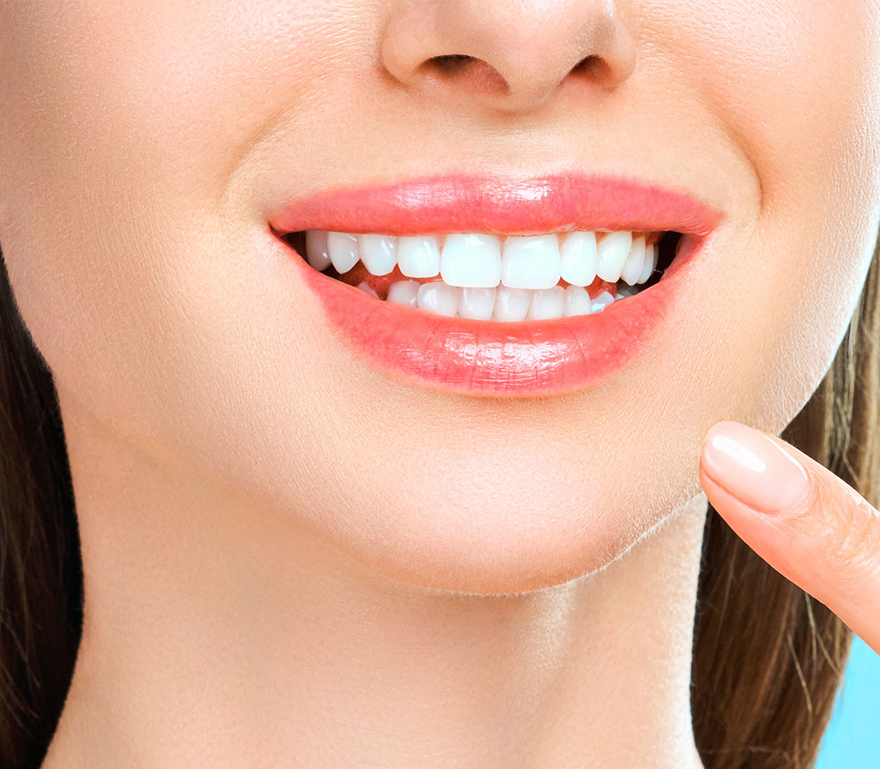 Estética do Sorriso - Dentes perfeitos